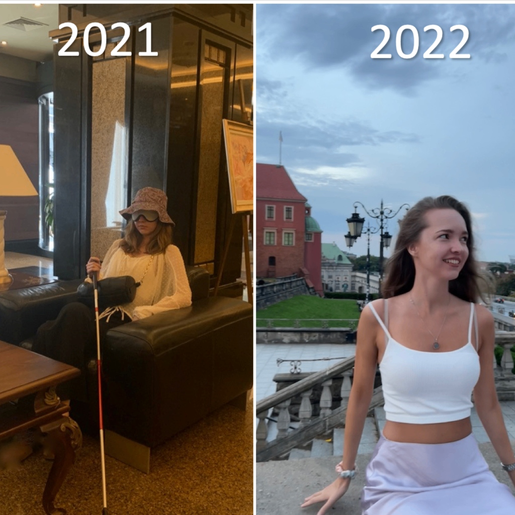 Before and After - 2021 vs 2022